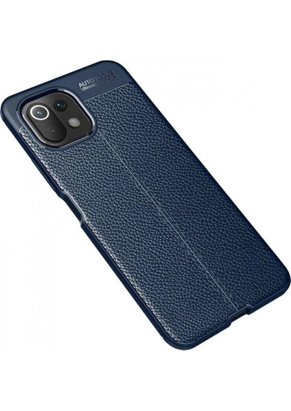 İEG Xiaomi Mİ 11 Lite Kılıf Auto Focus Kapak - Lacivert fiyatları