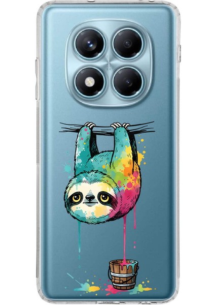 Redmi Note 14 Pro Plus ile Uyumlu Splash Tembel Hayvan Tasarımlı Şeffaf Silikon Kılıf