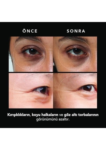 Faq Mikroiğneli Kırışıklık Karşıtı Hyaluronik Asit Göz Altı Pedleri – Göz Altı Şişlikleri ve Morluklara Karşı Pedler – Anında Etki – Seyahat Dostu – 3x2 Adet