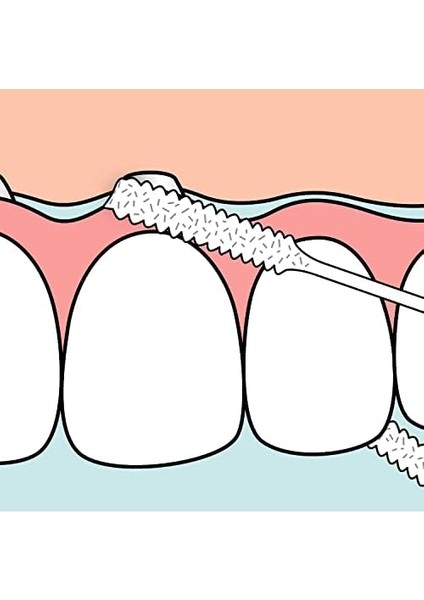 Tepe Bridge & Implant Floss (Diş Ipi)