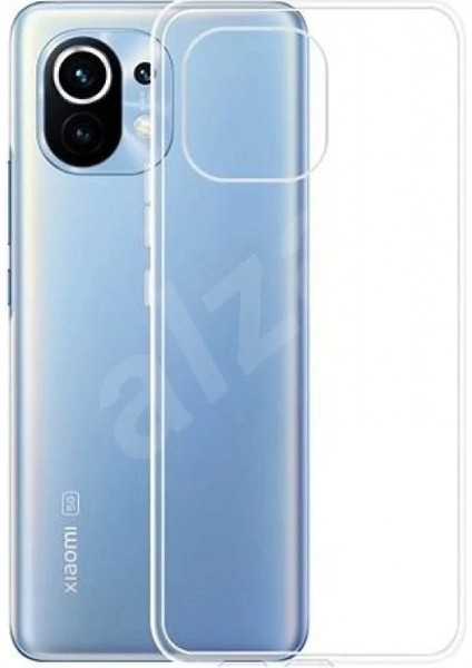 Xiaomi Mi 11 Kılıf Lüx Şeffaf Silikon fiyatları