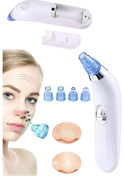 Bfs Vakumlu Siyah Nokta ve Yüz Temizleme Cihazı 4 Başlıklı