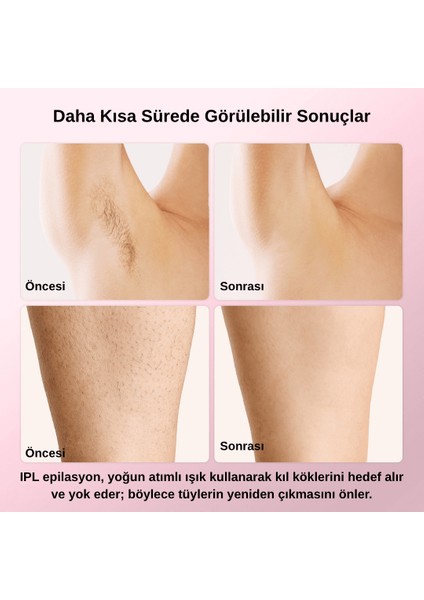 T4 Taşınabilir Ipl Lazer Epilasyon Cihazı – Ev Tipi Tüy Giderme Aleti indirimleri