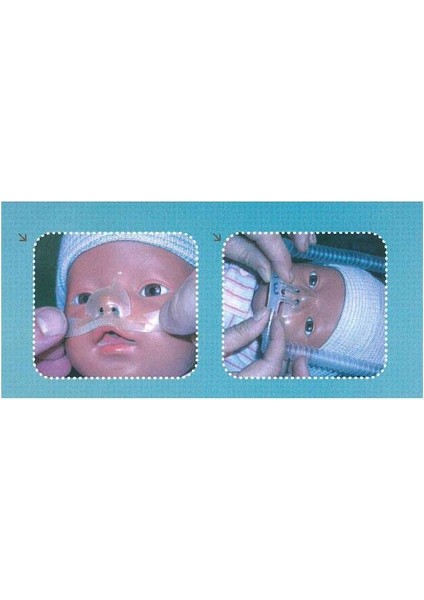 Hidrokolloid Burun Bandı No:1