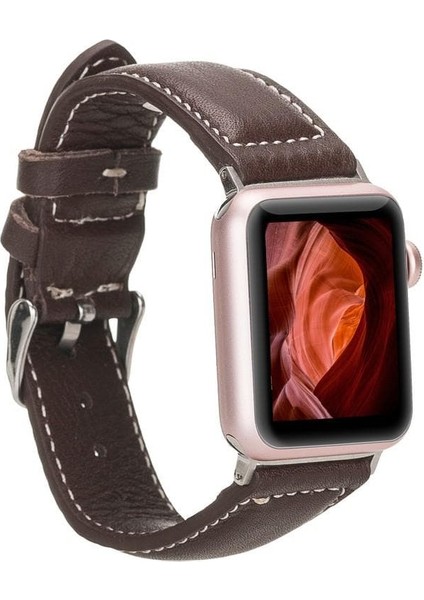 Novira Flame Apple Watch Deri Kordon