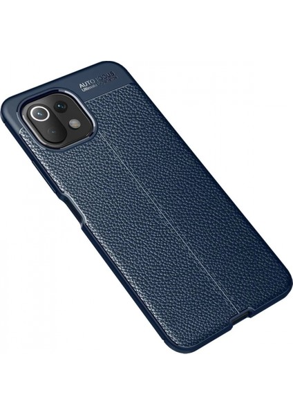 Xiaomi Mi 11 Lite Kılıf Auto Focus Kapak - Lacivert fiyatları