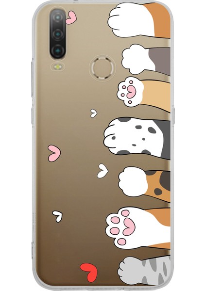 General Mobile Gm 10 Uyumlu Sevimli Kedi Patiler Tasarımlı Baskılı Silikon Kılıf