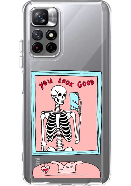 Redmi 10 Uyumlu You Look Good Iskelet Tasarımlı Baskılı Silikon Kılıf