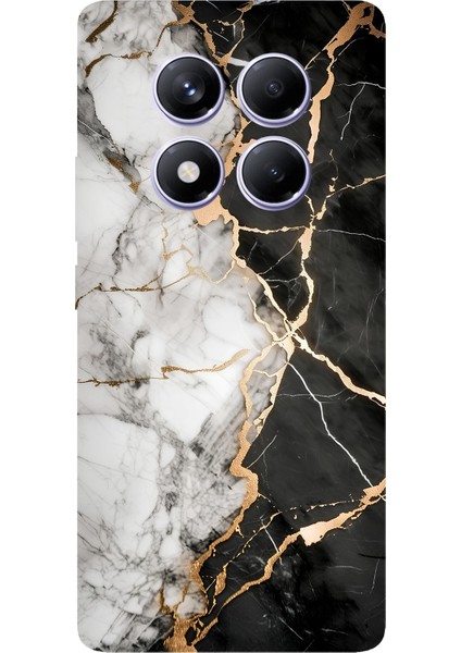 Redmi Note 14 Pro Plus 5g Uyumlu Siyah Beyaz Mermer Baskılı Silikon Kılıf
