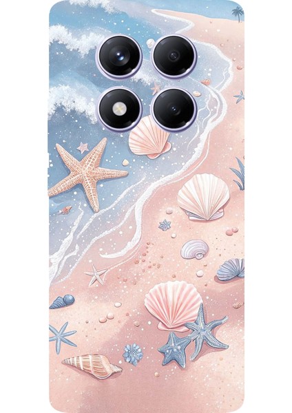 Redmi Note 14 Pro Plus 5g Uyumlu Sahil Deniz Kabuğu Baskılı Silikon Kılıf