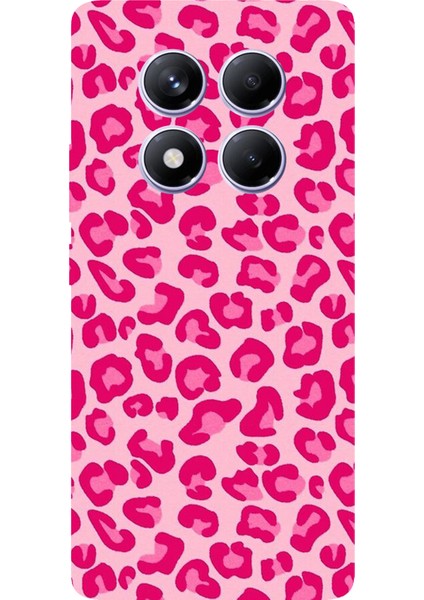 Redmi Note 14 Pro Plus 5g Uyumlu Pembe Leopar Tasarımlı Baskılı Silikon Kılıf