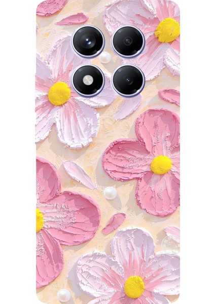 Redmi Note 14 Pro Plus 5g Uyumlu Pembe Beyaz Çiçekler Sulu Boya Baskılı Silikon Kılıf