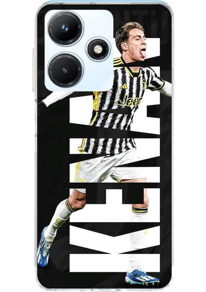 Infinix Hot 30I Uyumlu Kenan Yıldız Sevinç Baskılı Silikon Kılıf