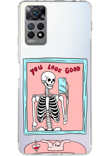 Redmi Note 11 Pro Uyumlu You Look Good Iskelet Tasarımlı Baskılı Silikon Kılıf