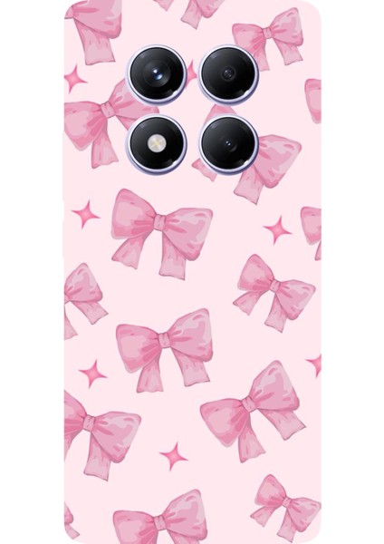 Redmi Note 14 Pro Plus 5g Uyumlu Pembe Fiyonklar Baskılı Silikon Kılıf