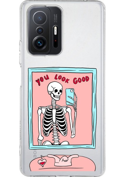 Xiaomi Mi 11T - 11T Pro Uyumlu You Look Good Iskelet Tasarımlı Baskılı Silikon Kılıf