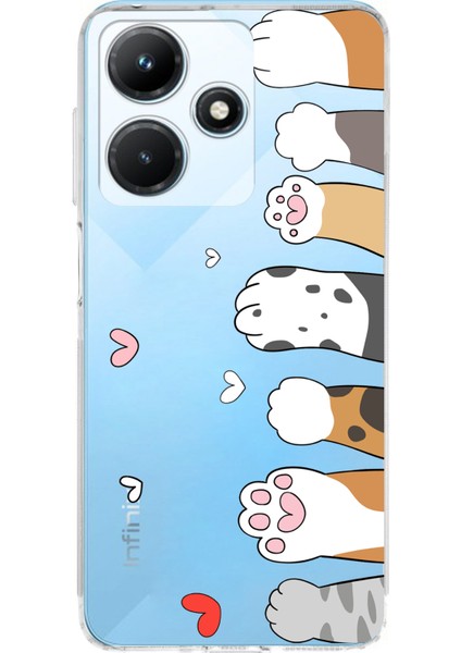 Infinix Hot 30I Uyumlu Sevimli Kedi Patiler Tasarımlı Baskılı Silikon Kılıf