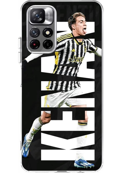 Redmi 10 Uyumlu Kenan Yıldız Sevinç Baskılı Silikon Kılıf