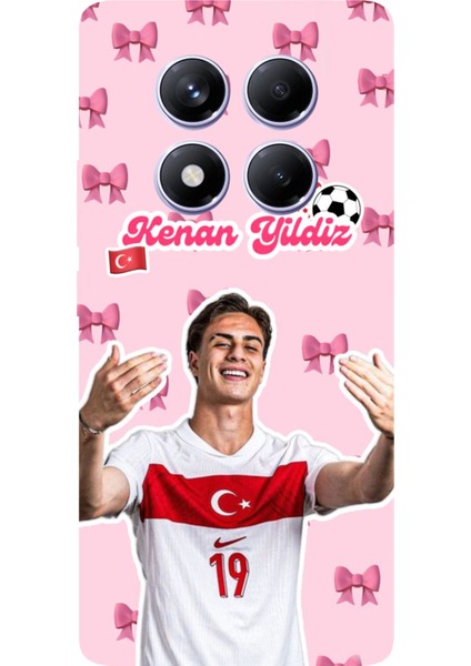 Redmi Note 14 Pro Plus 5g Uyumlu Kenan Yıldız Kurdele Baskılı Silikon Kılıf