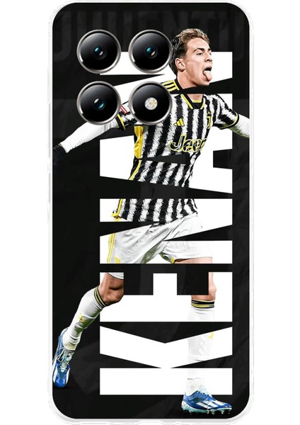 Xiaomi Mi 14T Uyumlu Kenan Yıldız Sevinç Baskılı Silikon Kılıf