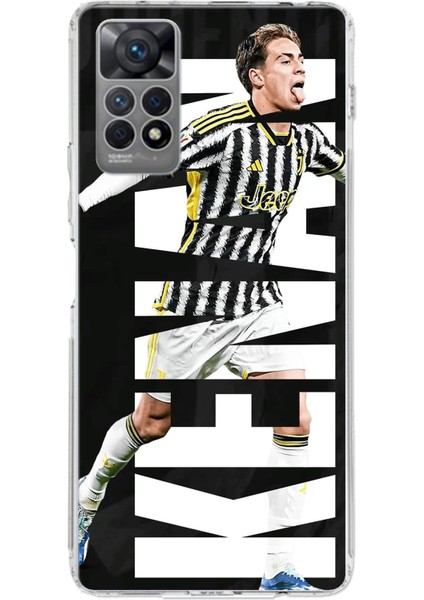 Redmi Note 12 Pro 4g Uyumlu Kenan Yıldız Sevinç Baskılı Silikon Kılıf