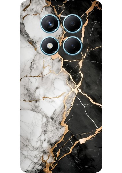 Redmi Note 14 Pro 4g Uyumlu Siyah Beyaz Mermer Baskılı Silikon Kılıf
