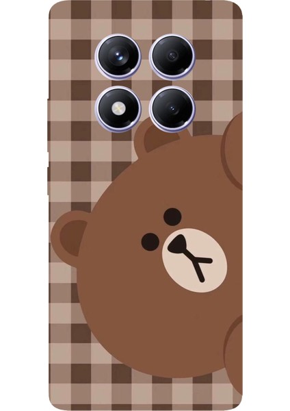 Redmi Note 14 Pro Plus 5g Uyumlu Kahverengi Ayı Yan Tasarımlı Baskılı Silikon Kılıf