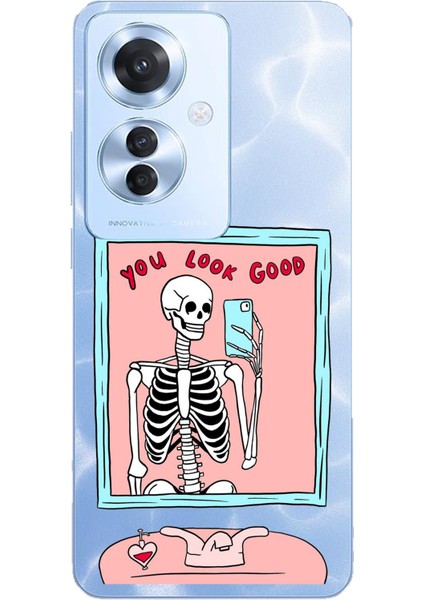 Oppo Reno 11F Uyumlu You Look Good Iskelet Tasarımlı Baskılı Silikon Kılıf