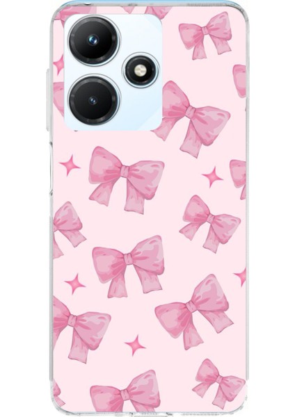 Infinix Hot 30I Uyumlu Pembe Fiyonklar Baskılı Silikon Kılıf