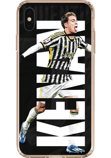 iPhone Xs Max Uyumlu Kenan Yıldız Sevinç Baskılı Silikon Kılıf