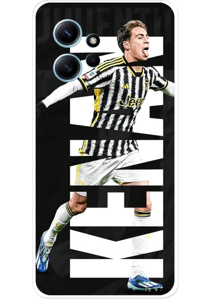 Redmi Note 12 4g Uyumlu Kenan Yıldız Sevinç Baskılı Silikon Kılıf