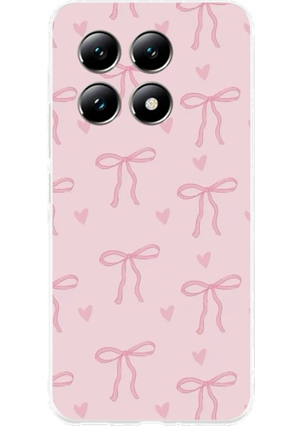 Xiaomi Mi 14T Pro Uyumlu Pembe Kalpli Fiyonklar Baskılı Silikon Kılıf