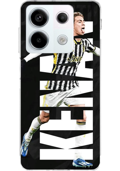 Redmi Note 13 Pro 5g Uyumlu Kenan Yıldız Sevinç Baskılı Silikon Kılıf