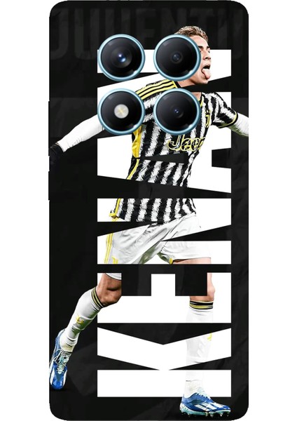 Redmi Note 14 Pro 4g Uyumlu Kenan Yıldız Sevinç Baskılı Silikon Kılıf