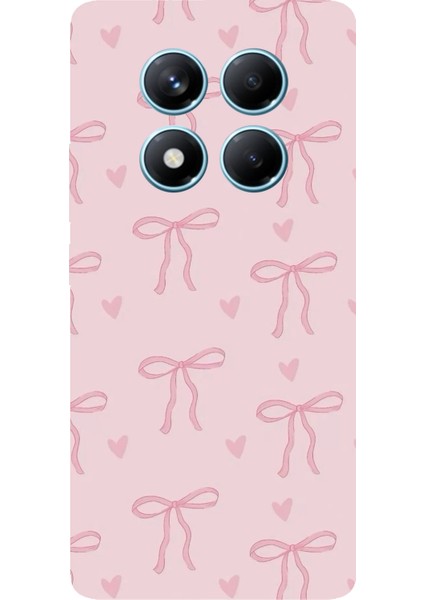 Redmi Note 14 Pro 4g Uyumlu Pembe Kalpli Fiyonklar Baskılı Silikon Kılıf