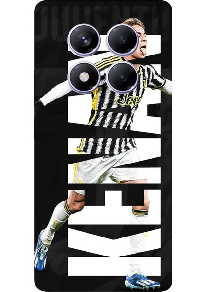 Redmi Note 14 Pro Plus 5g Uyumlu Kenan Yıldız Sevinç Baskılı Silikon Kılıf