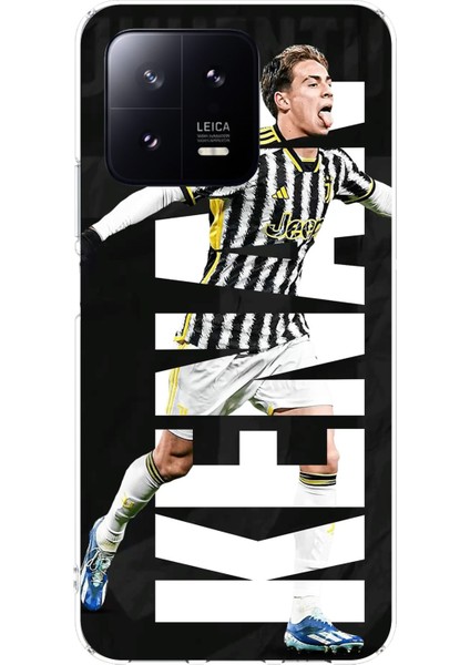 Xiaomi Mi 13 Uyumlu Kenan Yıldız Sevinç Baskılı Silikon Kılıf