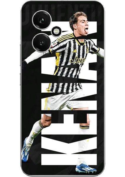 Honor 400 Uyumlu Kenan Yıldız Sevinç Baskılı Silikon Kılıf