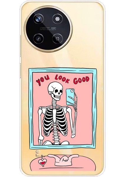 Realme 11 4g Uyumlu You Look Good Iskelet Tasarımlı Baskılı Silikon Kılıf