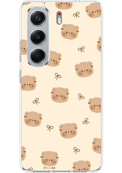 Tecno Camon 40 Pro Uyumlu Sevimli Ayıcıklar Baskılı Silikon Kılıf