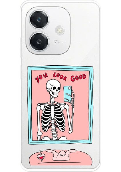 Oppo A3 Uyumlu You Look Good Iskelet Tasarımlı Baskılı Silikon Kılıf