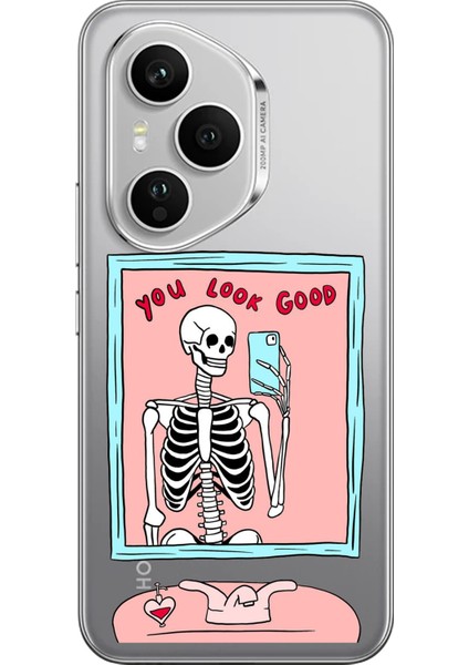 Honor 400 Pro Uyumlu You Look Good Iskelet Tasarımlı Baskılı Silikon Kılıf
