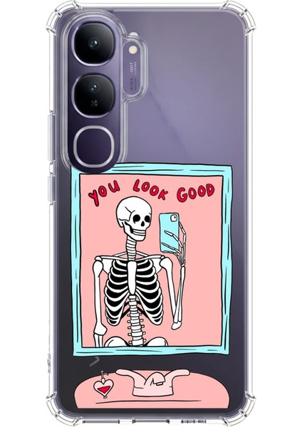 Vivo V40 Lite Uyumlu You Look Good Iskelet Tasarımlı Baskılı Silikon Kılıf