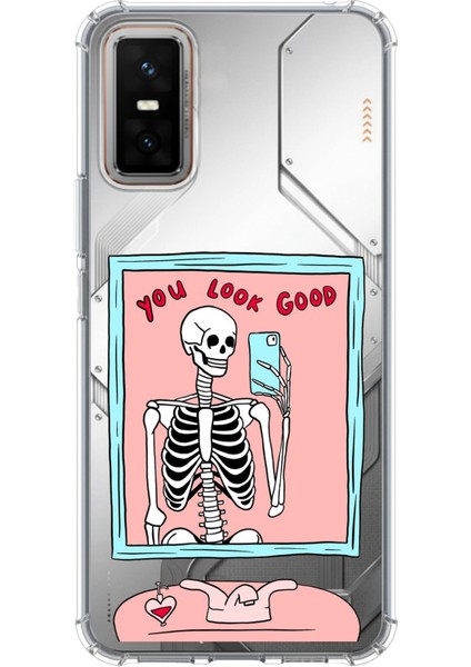 Infinix Gt 30 Pro Uyumlu You Look Good Iskelet Tasarımlı Baskılı Silikon Kılıf