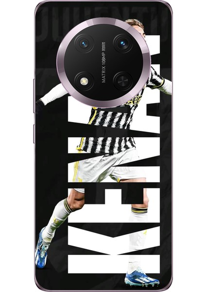 Honor Magic 7 Lite Uyumlu Kenan Yıldız Sevinç Baskılı Silikon Kılıf