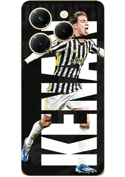 Tecno Spark 20 Pro Uyumlu Kenan Yıldız Sevinç Baskılı Silikon Kılıf