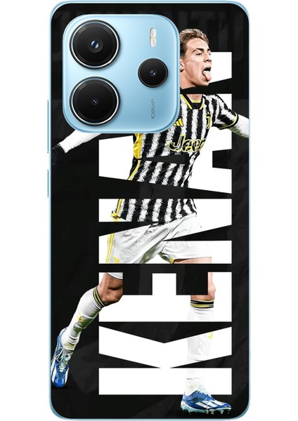 Redmi Note 14 4g Uyumlu Kenan Yıldız Sevinç Baskılı Silikon Kılıf