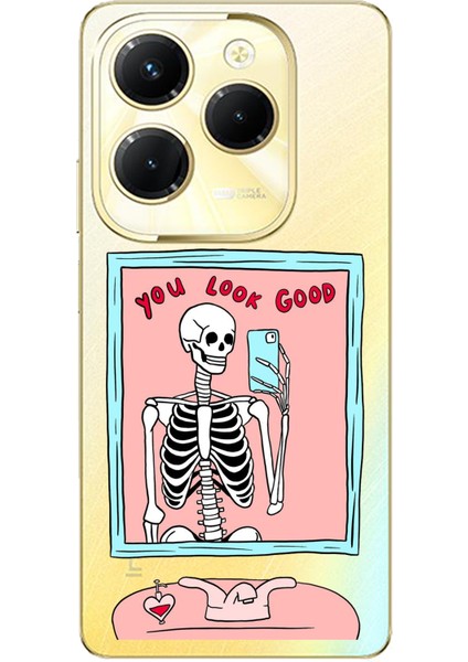 Tecno Spark 20 Pro Uyumlu You Look Good Iskelet Tasarımlı Baskılı Silikon Kılıf