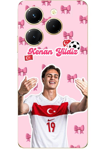 Tecno Spark 20 Pro Uyumlu Kenan Yıldız Kurdele Baskılı Silikon Kılıf