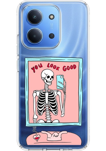Redmi 15C Uyumlu You Look Good Iskelet Tasarımlı Baskılı Silikon Kılıf
